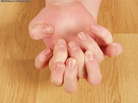 Hairy Woman Fingers Herself and Spreads – photo 15 of 16