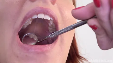 Redhead Parts Her Lips for Dental Exam – photo 14 of 15
