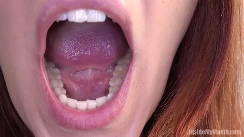 Redhead Parts Her Lips for Dental Exam – photo 5 of 15
