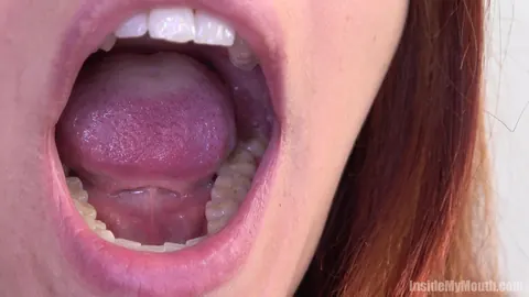 Redhead Parts Her Lips for Dental Exam – photo 3 of 15