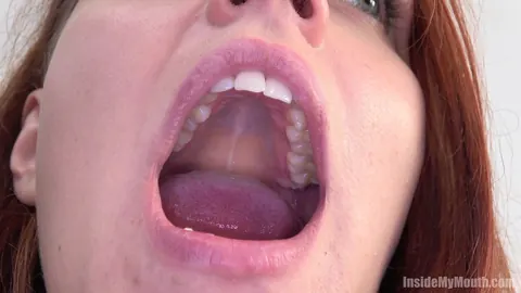 Redhead Parts Her Lips for Dental Exam – photo 12 of 15
