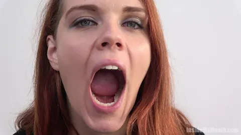Redhead Parts Her Lips for Dental Exam – photo 2 of 15