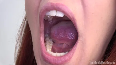 Redhead Parts Her Lips for Dental Exam – photo 11 of 15