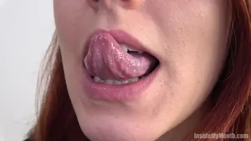 Redhead Parts Her Lips for Dental Exam