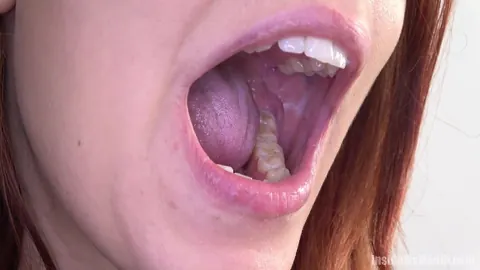 Redhead Parts Her Lips for Dental Exam – photo 9 of 15