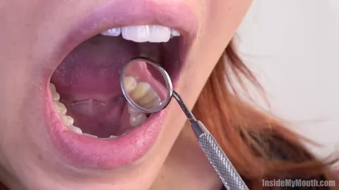 Redhead Parts Her Lips for Dental Exam – photo 15 of 15