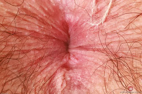 Busty Redhead with Short Hair and Glasses Shows Her Hairy Pussy – photo 20 of 20