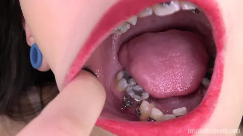 Brunette with Braces Opens Wide for the Camera – photo 10 of 15