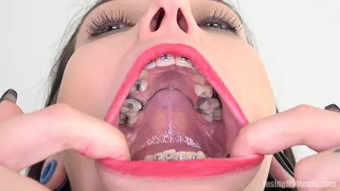 Brunette with Braces Opens Wide for the Camera – photo 2 of 15