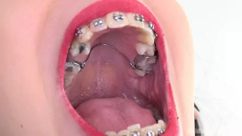 Brunette with Braces Opens Wide for the Camera – photo 9 of 15